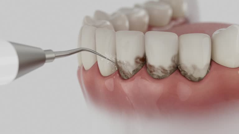 Trusted Dental Implants service in Vilonia, AR - Dentist Open Now